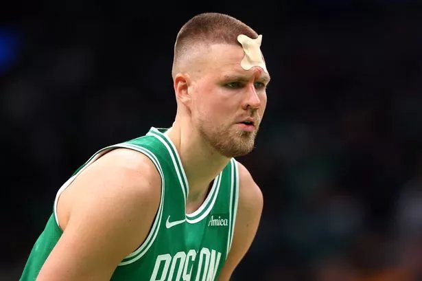 Kristaps Porzingis suffered a massive cut on his forehead during Wednesday's game